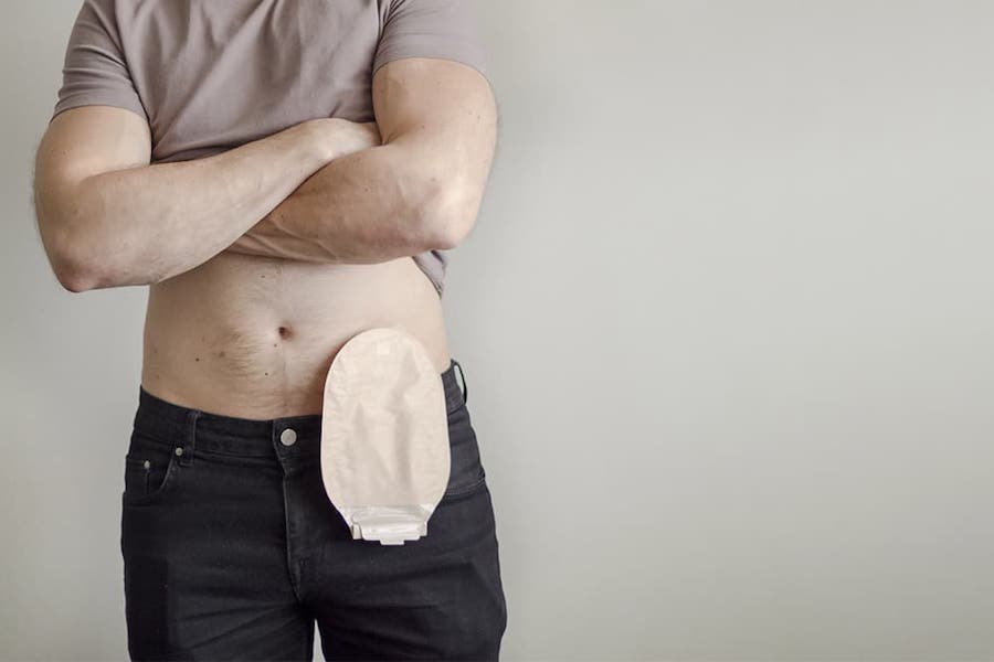traitement-stomies-infirmier-domicile-thionville